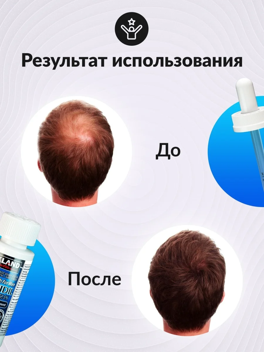 Генеролон Отзывы Цена В Аптеках