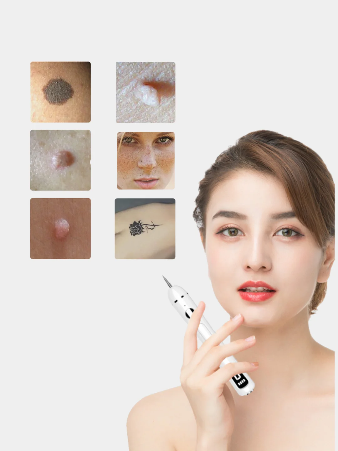 Лазерная машинка для удаления папилом, веснушек,татуировок и бородавок ...