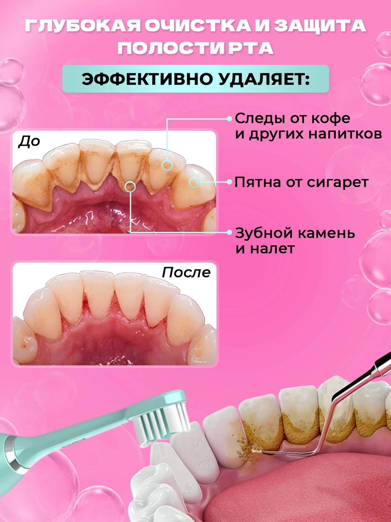 можно делать минет после удаления зуба фото 114