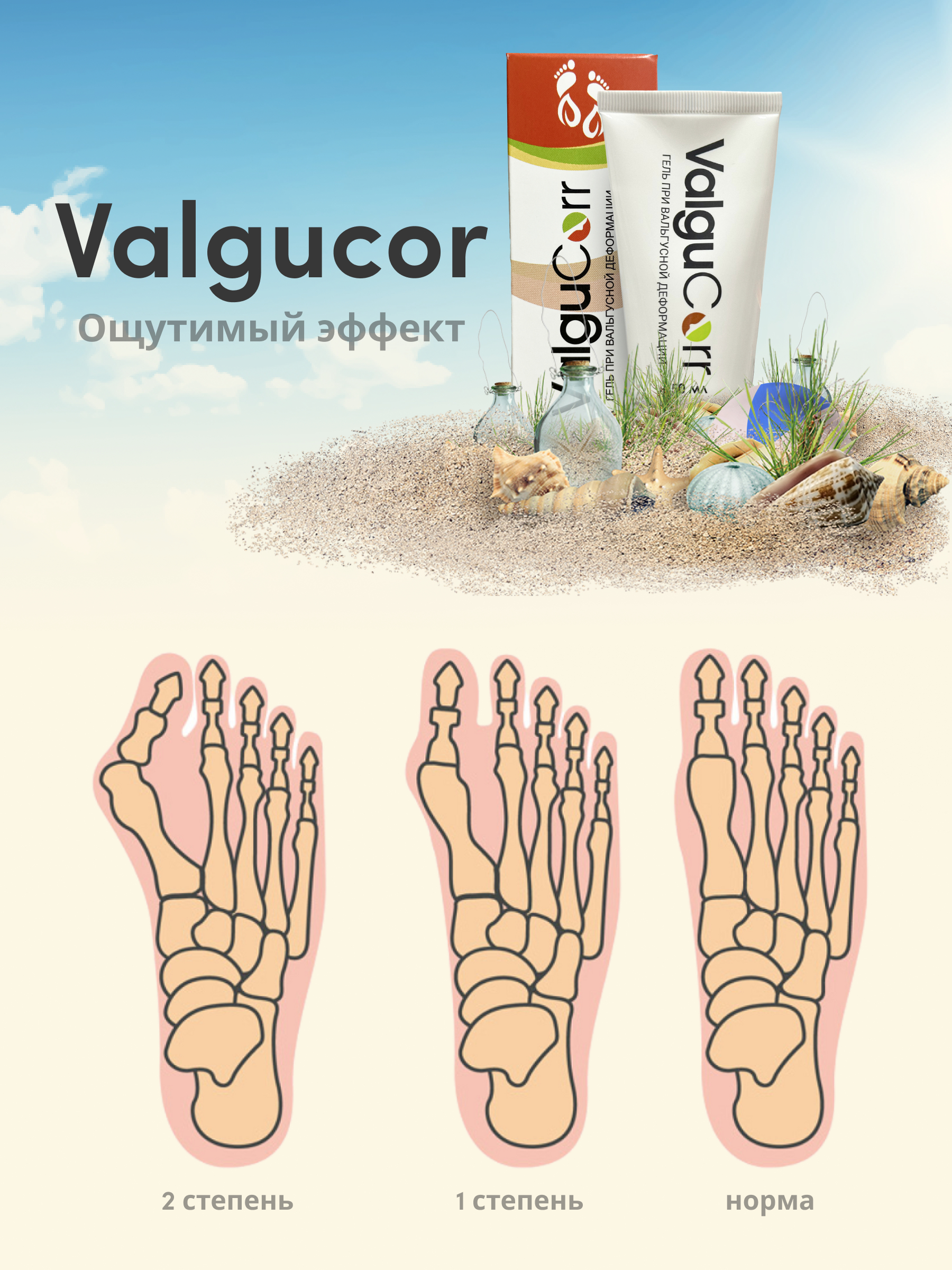 Valgucorr отзывы